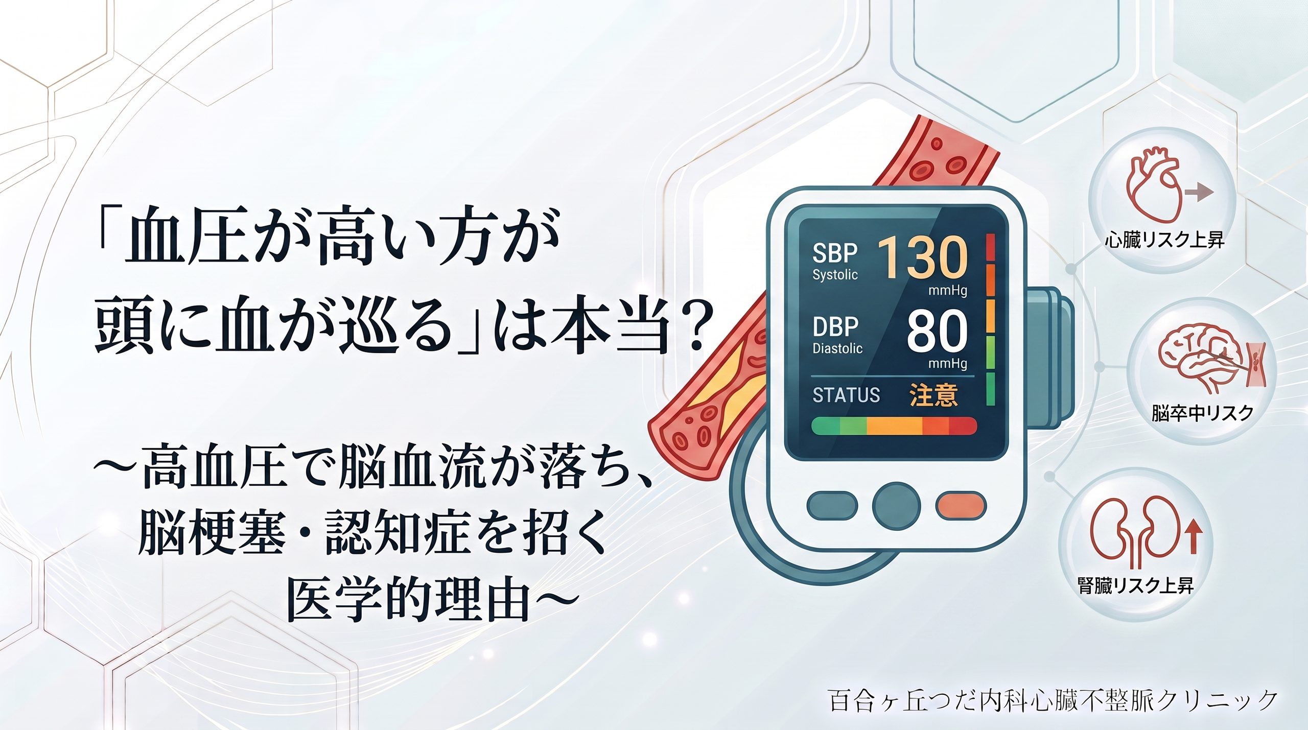「血圧が高い方が頭に血が巡る」は本当？〜高血圧で脳血流が落ち、脳梗塞・認知症を招く医学的理由〜